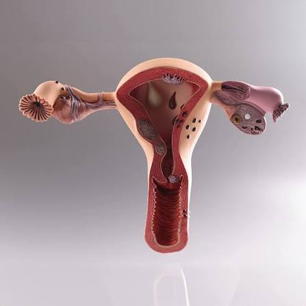 Vaginal Cancer